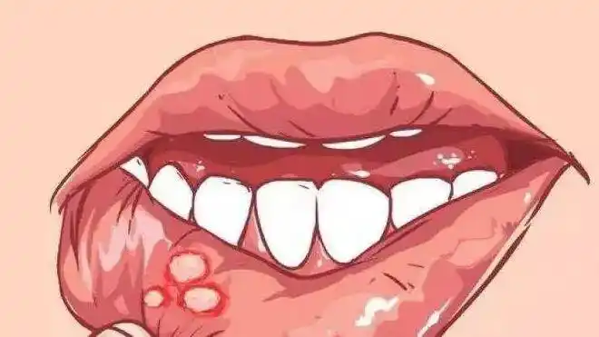 必看系统性红斑狼疮健康指导和自我管理手册