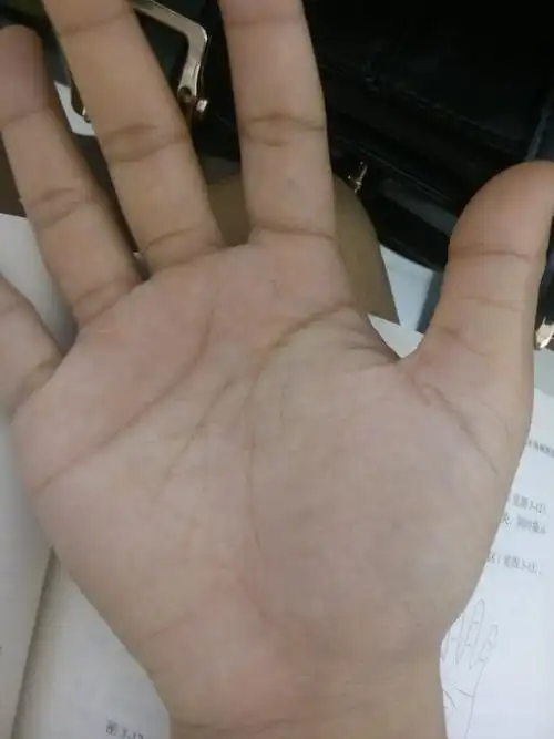 女,22岁,右手掌纹生命线中间短了,有一位老师说我三四十岁的时候有
