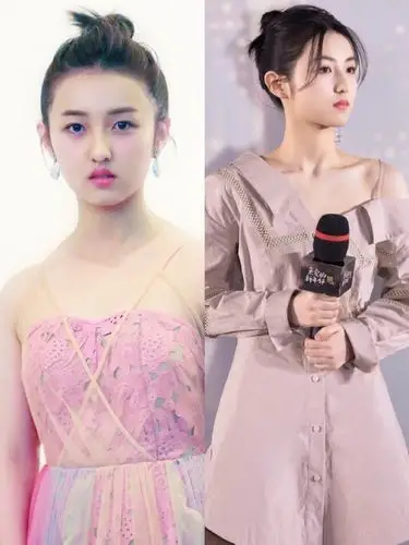 张子枫的直角肩秘籍你值得拥有·95张子枫得斜方肌发达_圈子-新氧