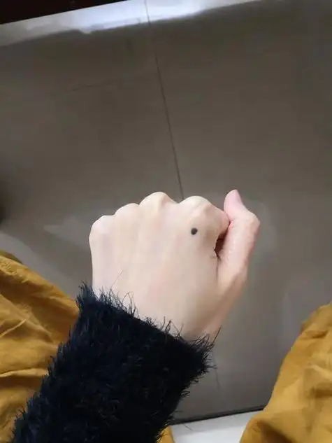 老人说右手突然长痣代表什么