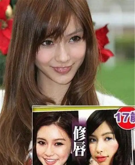 杨颖整容前后照片,baby整容前(杨颖整过容?