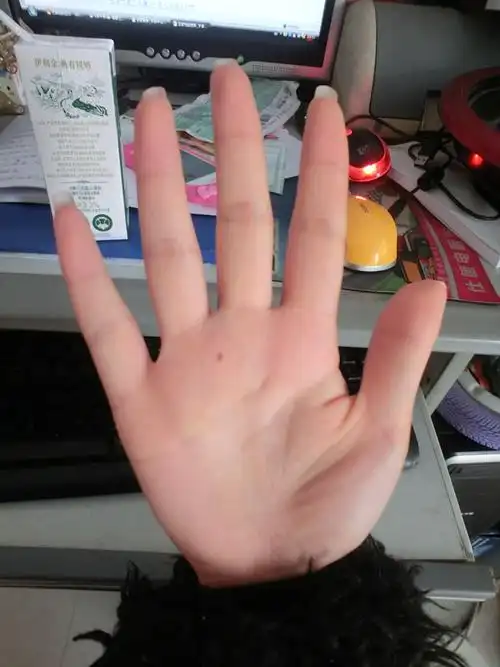 女的,右手掌正中间有一颗痣,有什么寓意吗?有图