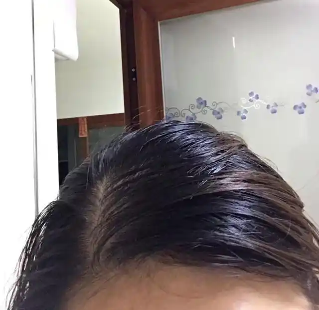 头发太爱出油看起来很邋遢?试试做到这几点,不用每天洗头也清爽