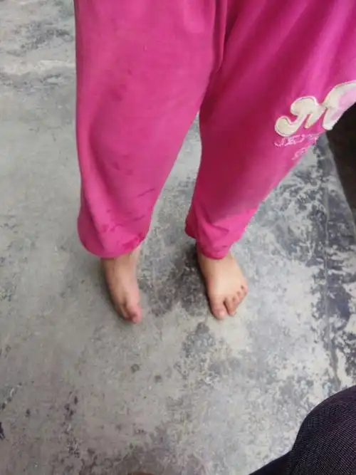 发现很多孩子在这么冷的天气还是穿拖鞋.