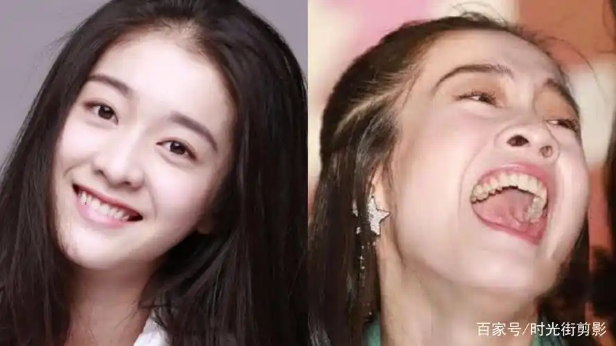 女明星笑与不笑竟然差别这么大!看看谁在大笑时还能颜值不倒?