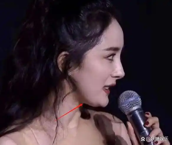 杨幂参加晚会生图爆缺点港风造型翻车很显老整牙后遗症明显