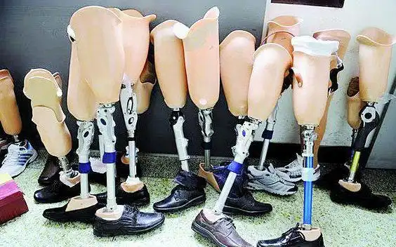 假肢脚穿鞋很费劲还磨鞋要怎么办