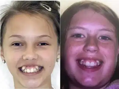 那你的是虎牙还是獠牙?