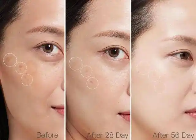 哪种护肤品美白补水祛斑效果好,不吹不黑的淡斑护肤品