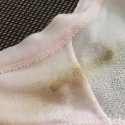 怀孕三十五天肚子疼,内裤上还有黄色的分泌物,是什麼原因?