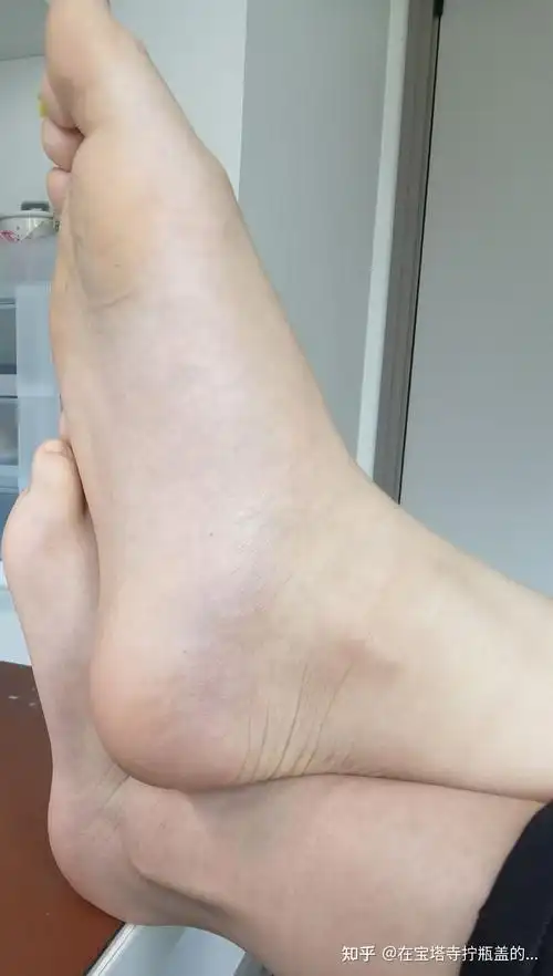 有没有男生光脚的照片? - 知乎