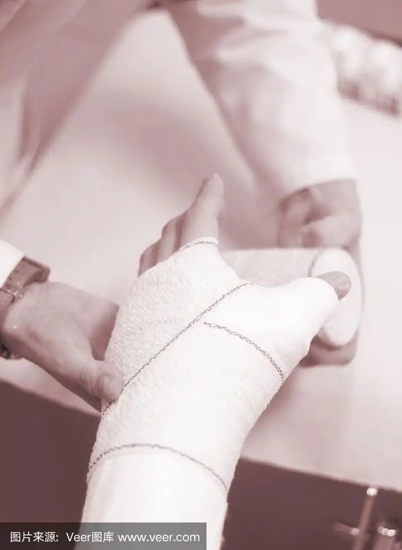 骨折后,医生在患者前臂和手腕上使用石膏石膏和绷带固定.