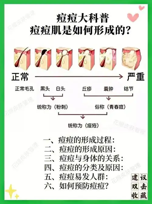 痘痘肌肤大科普