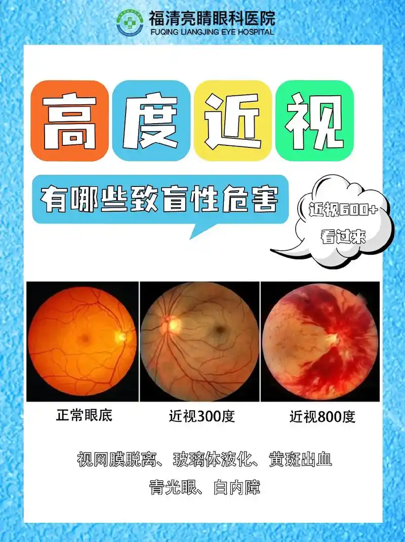 高度近视的危害,比你想象中更可怕60.98近视600度以上就是 - 抖音