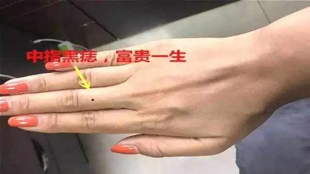 小指有痣的女人手相运势极佳子孙满堂一生得贵人运