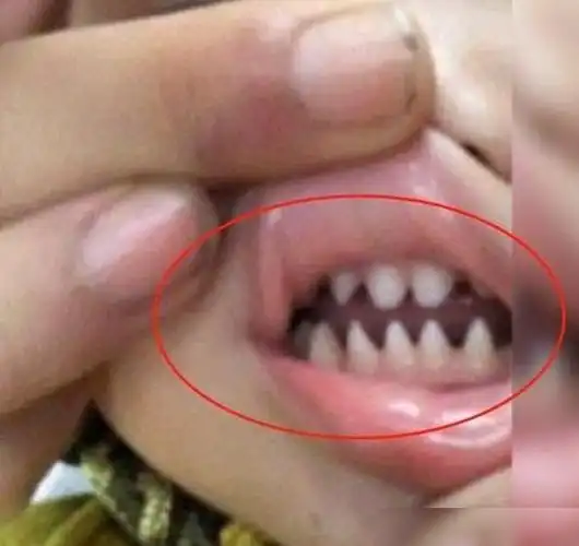 奶奶赶紧喊孩子妈妈来看,两人把孩子送到医院检查,医生看了之后就批评