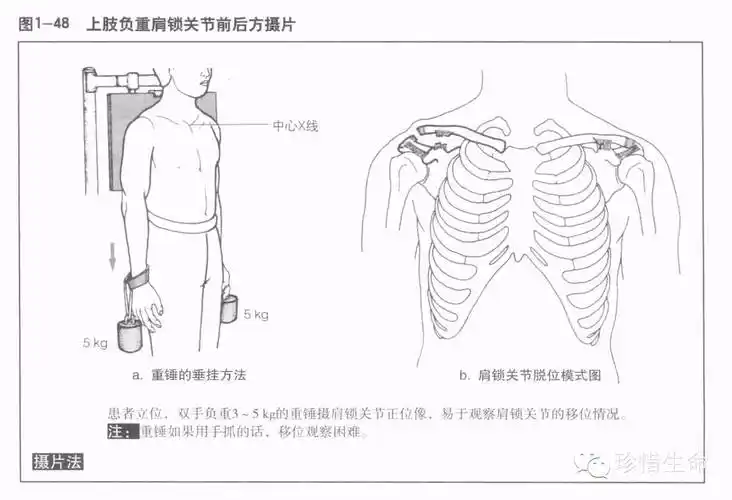 肩关节x线检查体位大全
