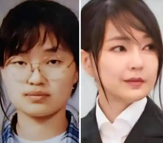 小姐妹们要是问她的保养秘籍就大可不必了,因为金建希的保养全靠整容.