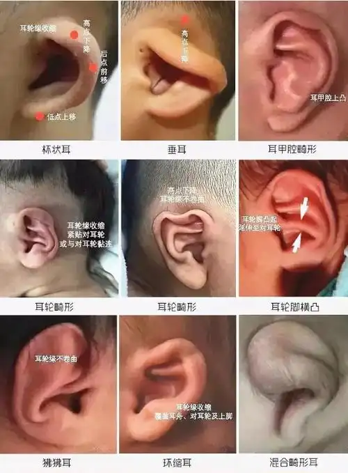 耳朵形状分类_全民k歌网