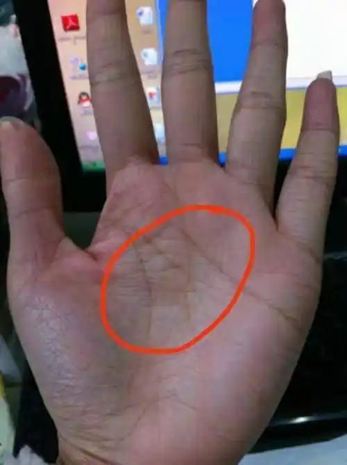 人会因为婚姻或感情而获得好的财运或财产如果三角纹出现在生命线上