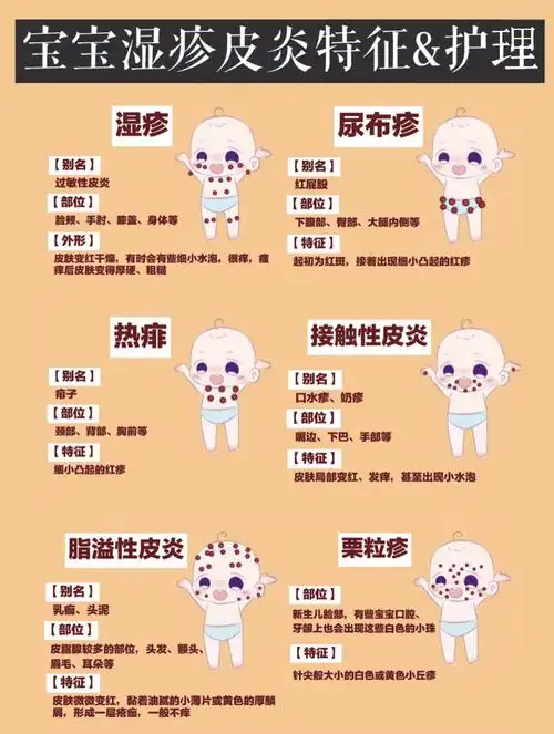 宝宝湿疹热疹痱子如何分辨?如何护理?你都了解吗?