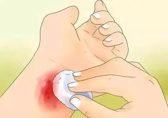 白癜风病因以及最新治疗.曹金广皮肤科