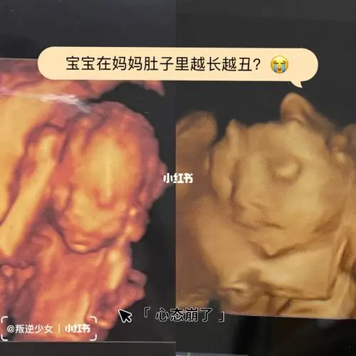 做完四维心态崩了…为啥我的宝宝这么丑