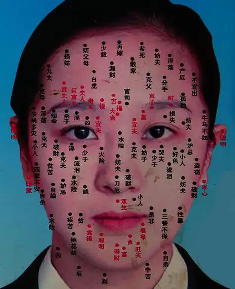 脸上有颗痣去哪里去掉安全,脸上有痣怎么除掉