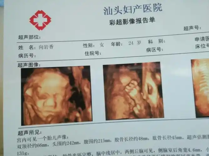 四维宝宝怎么没下巴