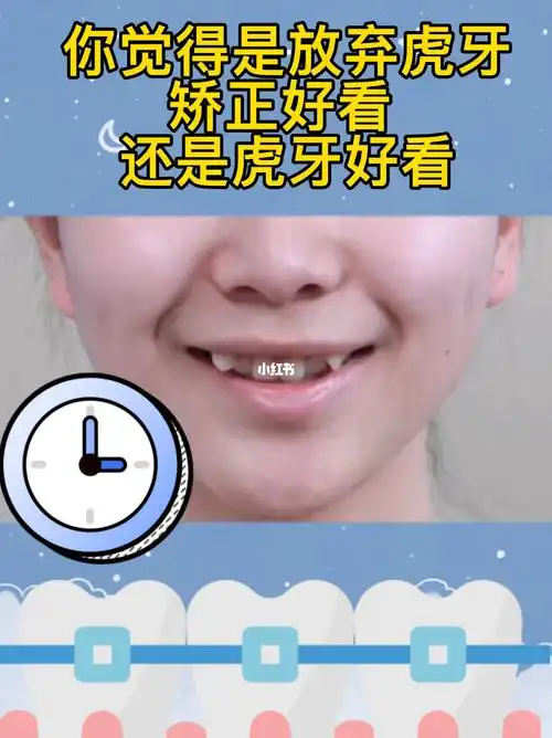 你觉得虎牙用做矫正吗