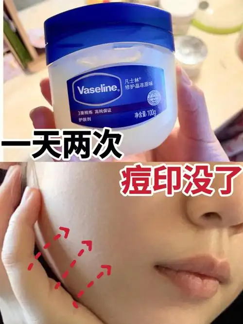 大彻大悟!去痘印原来这么简单!