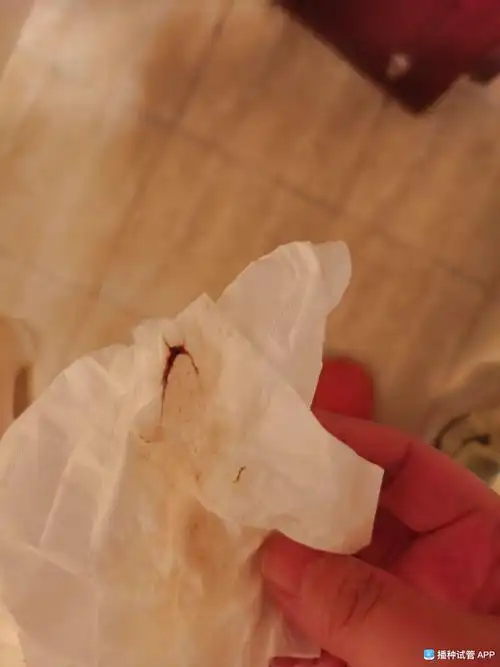 [试管婴儿]9周2天,上厕所出血褐色血渍