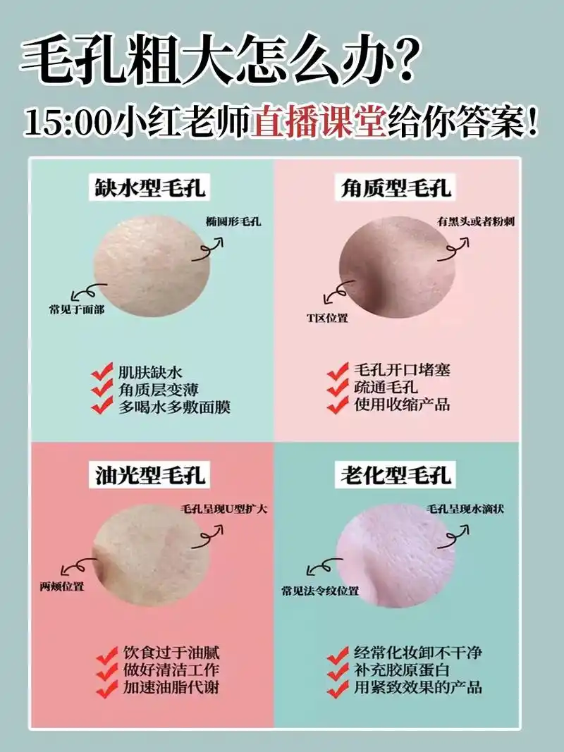 一张图分清你是哪种毛孔粗大类型97.下午15:00来直播间教 - 抖音