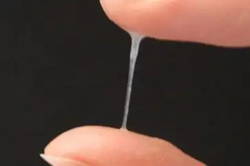 但如果是女性生理期间白带量可能会少年,形态变成白色糊状或蛋清样