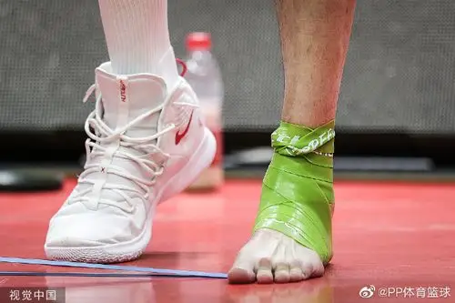 周琦受伤脚踝特写 这大脚至少得50码吧?
