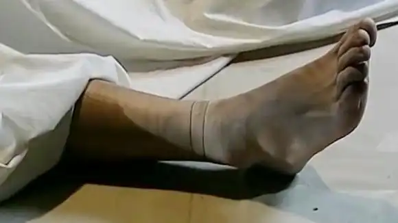 大叔停尸房查看尸体,竟在尸体的手上和脚上发现两道痕迹!