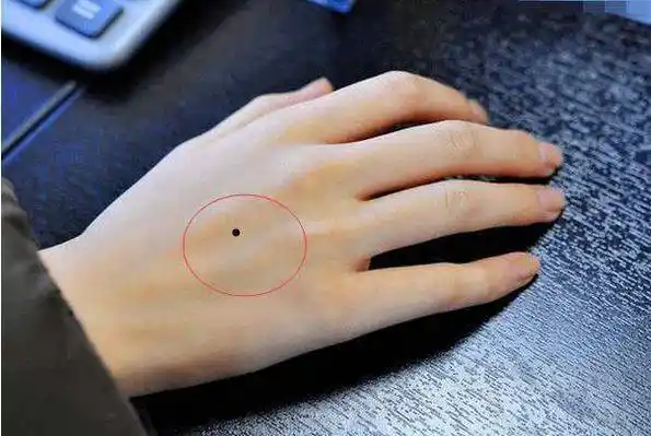 手背有痣我们都知道手中有吉痣是手握聚宝盆,但是手心手背都是肉,在