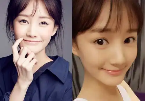 李一桐整容前后照片对比 其个人资料身高揭秘