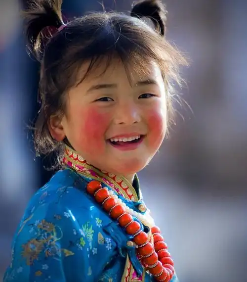 面部有高原红怎么办,如何防治高原红脸蛋