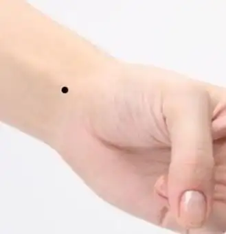 手腕处有痣的具体意义图文详解