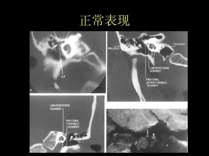 精品推荐医学影像诊断ppt课件 卵巢肿瘤 鞍区肿瘤 面神经解剖 中枢