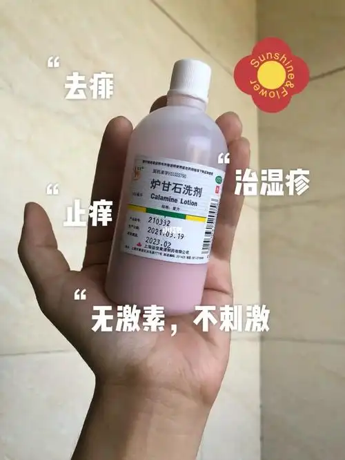 宝宝炉甘石洗剂去痱止痒治湿疹