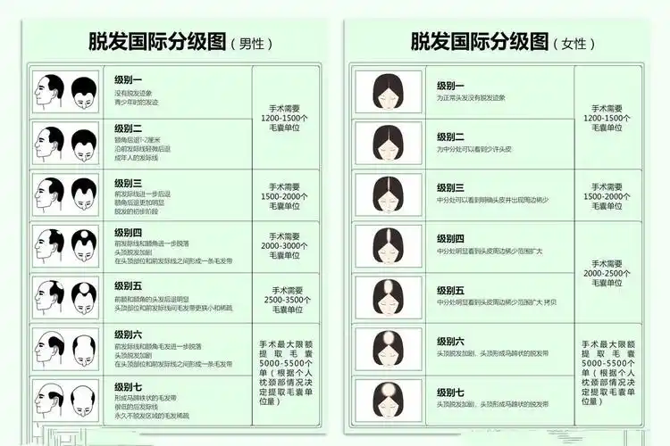 天津熙朵植发一般要多少个毛囊单位?植发密度多少合适?