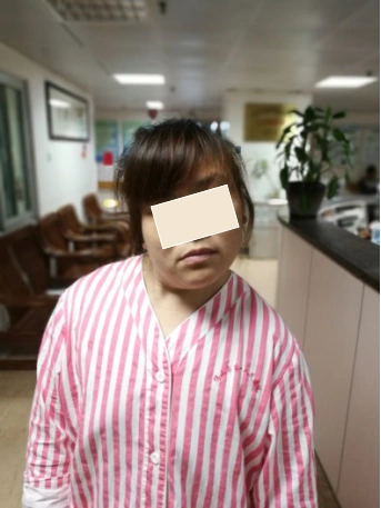歪脖子大妈术前.png