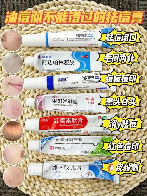 优必辰针对:痘痘痘印4.甲硝唑针对:黑头白头5.红霉素针对:消y祛痘6.