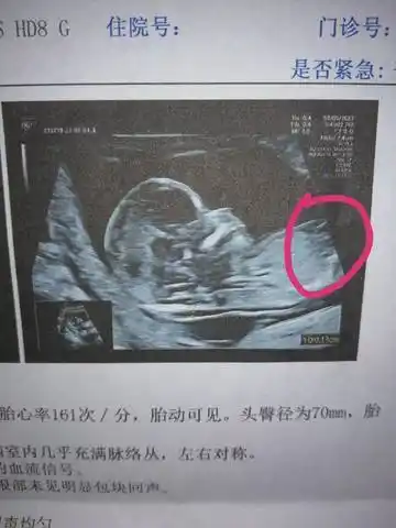 这个是三条线吗是不是女宝