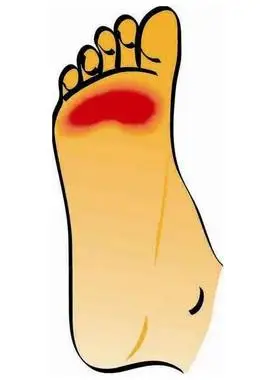我的前脚掌为何总是疼痛?