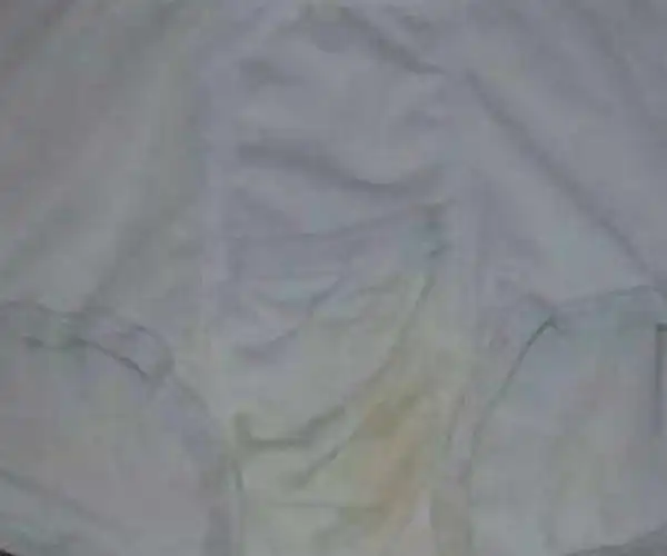 就很有可能是由于白带过多所导致的,因为如果白带在内裤上带的时间过