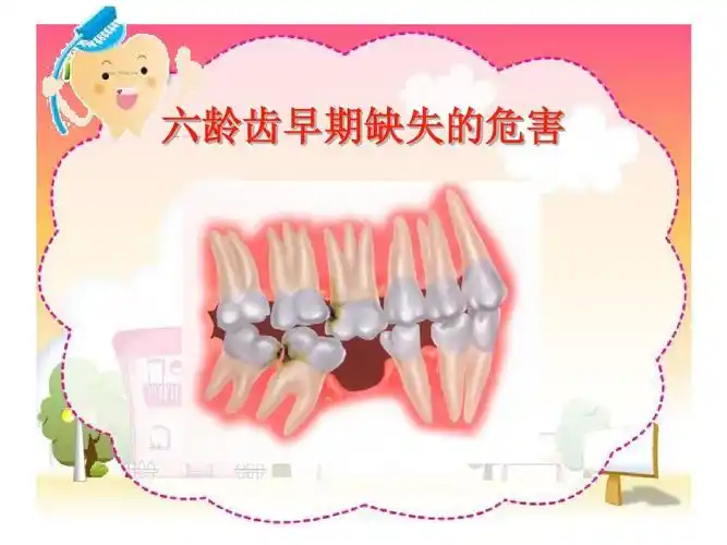 六龄齿早期缺失的危害