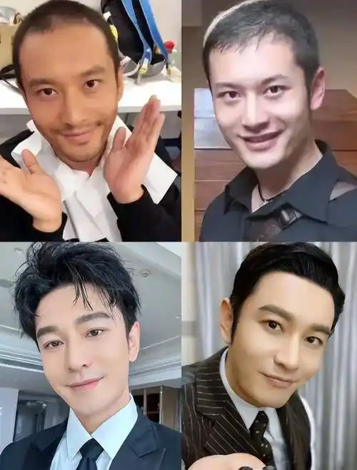黄晓明头发忽多忽少,是植发还是假发套?